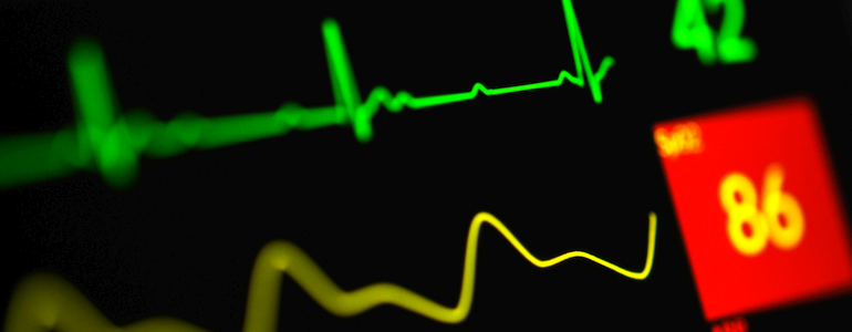 A close up of a patient monitor screen with a heart beat